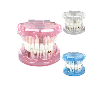 Pregledna Zob Model Zobne Bolezni Vsadek Zob Model Odstranljive, Zobozdravnik Standard Zob Patološkega Predstavitvene - Poučevanje